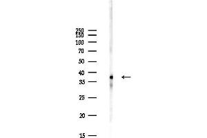 anti-Tribbles Homolog 3 (Drosophila) (TRIB3) (N-Term) antibody