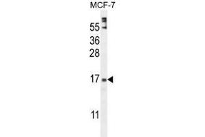 ZNF720 Antibody (Center) western blot analysis in MCF-7 cell line lysates (35 µg/lane). (ZNF720 Antikörper  (Middle Region))