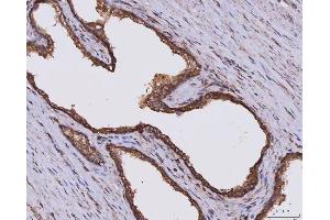 IHC analysis of CLASP1 using anti-CLASP1 antibody (ABIN7599144). (CLASP1 Antikörper  (AA 1-243))