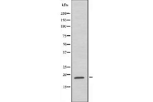 Western blot analysis of extracts from HeLa cells,using RPL35 antibody. (RPL35 Antikörper  (C-Term))
