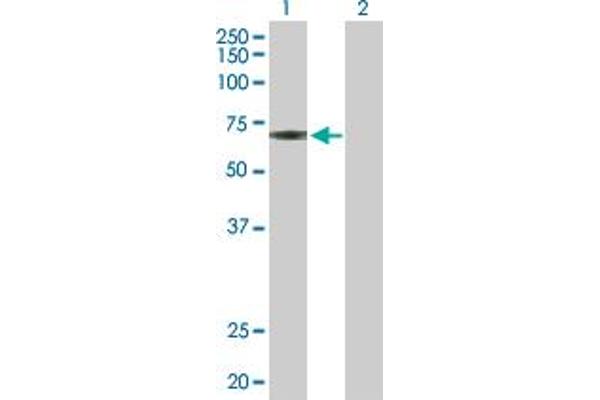 JMJD2D Antikörper  (AA 1-523)