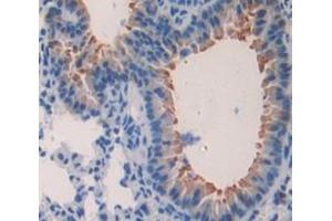 IHC-P analysis of Kidney tissue, with DAB staining. (Surfactant Protein C Antikörper  (AA 1-193))
