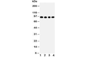 Western blot testing of ADAM17 antibody and Lane 1:  human placenta;  2: HeLa;  3: PANC;  4: 293T cell lysate. (ADAM17 Antikörper  (C-Term))