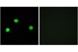 Immunofluorescence analysis of COS7 cells, using IP6K2 Antibody.