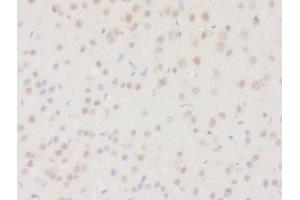 Formalin-fixed and paraffin embedded rat brain tissue labeled with Rabbit Anti-DHRS2 Polyclonal Antibody, Unconjugated (ABIN2559682) at 1:200 followed by conjugation to the secondary antibody and DAB staining (DHRS2 Antikörper  (AA 61-160))