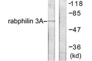 Western blot analysis of extracts from HeLa cells, treated with TNF-a 20ng/ml 2', using Rabphilin 3A (Ab-Ser237) Antibody. (RPH3A Antikörper  (AA 203-252))