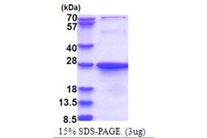 Exosome Component 1 (EXOSC1) (AA 1-195) protein (His tag)