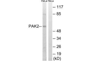 Western blot analysis of extracts from HeLa cells, treated with TSA (400nM, 24hours), using PAK2 (epitope around residue 141) antibody. (PAK2 Antikörper  (Ser141))