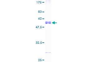 TPD52L2 Protein (AA 1-206) (GST tag)