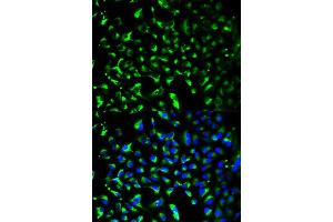 Immunofluorescence analysis of HeLa cell using PHB antibody.