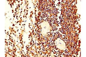 IHC image of ABIN7163556 diluted at 1:400 and staining in paraffin-embedded human spleen tissue performed on a Leica BondTM system. (LCP1 Antikörper  (AA 2-627))