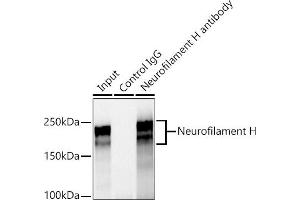 Immunoprecipitation analysis of 600 μg extracts of Rat brain cells using 3 μg Neurofilament H antibody (ABIN7268866). (NEFH Antikörper)
