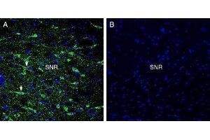 Expression of GPR52 in rat substantia nigra - Immunohistochemical staining of perfusion-fixed frozen rat brain sections with Anti-GPR52 Antibody (ABIN7043161, ABIN7044453 and ABIN7044454), (1:300), followed by goat anti-rabbit-AlexaFluor-488. (GPR52 Antikörper  (AA 239-253))