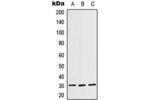 Western blot analysis of RPS4X expression in A431 (A), SP2/0 (B), H9C2 (C) whole cell lysates. (RPS4X Antikörper  (Center))
