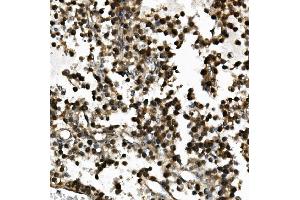 IHC analysis of USP44 using anti-USP44 antibody (ABIN7600640). (USP44 Antikörper  (AA 211-712))