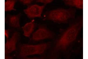 Immunofluorescence staining of methanol-fixed Hela cells using p56Dok-2(Phospho-Tyr299) Antibody. (DOK2 Antikörper  (pTyr299))
