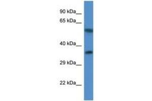 Image no. 1 for anti-Mitochondrial Ribosomal Protein L45 (MRPL45) (C-Term) antibody (ABIN6746836) (MRPL45 Antikörper  (C-Term))