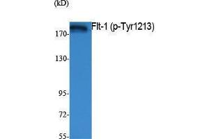 Western Blotting (WB) image for anti-Fms-Related tyrosine Kinase 1 (VEGFR1) (FLT1) (pTyr1213) antibody (ABIN3179854) (FLT1 Antikörper  (pTyr1213))