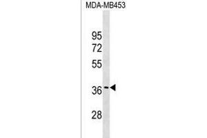 GJC3 Antibody (C-term) (ABIN1536946 and ABIN2849303) western blot analysis in MDA-M cell line lysates (35 μg/lane).