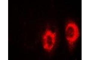 Immunofluorescent analysis of UBE2H staining in SW480 cells.