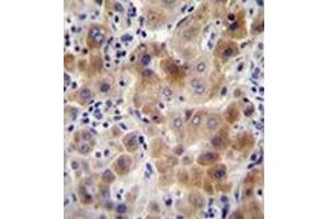 Immunohistochemistry analysis in formalin fixed and paraffin embedded human liver tissue reacted with NEU2 Antibody (N-term) followed which was peroxidase conjugated to the secondary antibody and followed by DAB staining. (NEU2 Antikörper  (N-Term))