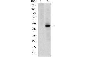 Western blot analysis using CDK9 mAb against HEK293 (1) and CDK9(AA: 178-369)-hIgGFc transfected HEK293 (2) cell lysate. (CDK9 Antikörper)