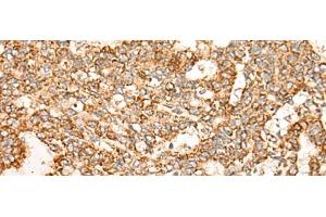 Immunohistochemistry (Paraffin-embedded Sections) (IHC (p)) image for anti-Nuclear Receptor Subfamily 0, Group B, Member 2 (NR0B2) antibody (ABIN7251844)