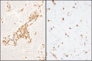Immunohistochemistry (IHC) image for anti-Coronin, Actin Binding Protein, 1A (CORO1A) (AA 250-300) antibody (ABIN7454693)