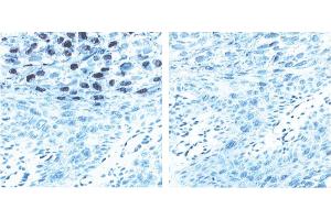 Immunohistochemistry (IHC) image for anti-L1 Protein antibody (ABIN967423)