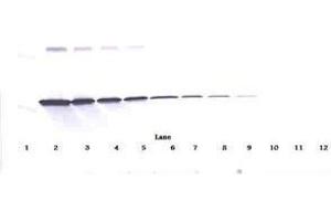 Image no. 2 for anti-Interferon gamma (IFNG) antibody (ABIN465161)