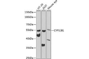 Western blot analysis of extracts of various cell lines, using CYP11B1 antibody (ABIN6130956, ABIN6139312, ABIN6139313 and ABIN6223585) at 1:1000 dilution. (CYP11B1 Antikörper  (AA 234-503))