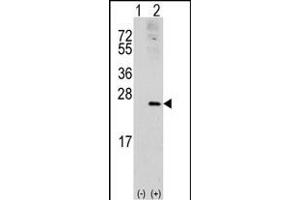 Western blot analysis of RAC1 (arrow) using rabbit polyclonal RAC1 Antibody (S71) (ABIN391836 and ABIN2841676). (RAC1 Antikörper  (AA 49-78))