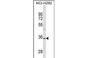 TSN18 Antibody (Center) (ABIN1538696 and ABIN2849649) western blot analysis in NCI- cell line lysates (35 μg/lane). (Tetraspanin 18 Antikörper  (AA 93-120))