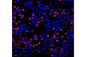 Immunofluorescence of paraffin embedded mouse kidney using Adenosine kinase (ABIN7072953) at dilution of 1: 300 (400x lens) (ADK Antikörper)