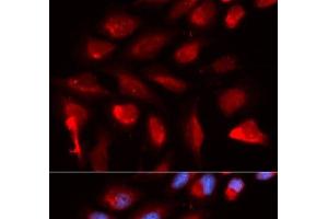 Immunofluorescence analysis of U2OS cells using PPARD Polyclonal Antibody