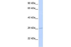 SLC25A6 antibody used at 1 ug/ml to detect target protein. (SLC25A6 Antikörper)
