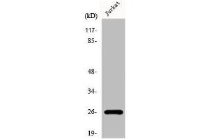 Western Blot analysis of Jurkat cells using Flt3-L Polyclonal Antibody (FLT3LG Antikörper  (C-Term))