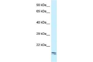WB Suggested Anti-Sec11c Antibody Titration: 1. (SEC11C Antikörper  (C-Term))