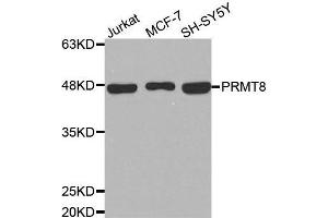 Western blot analysis of extracts of various cell lines, using PRMT8 antibody. (PRMT8 Antikörper)