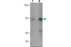 Western blot analysis of KREMEN2 in HeLa cell lysate with KREMEN2 polyclonal antibody  at (lane 1) 1 and (lane 2) 2 ug/mL. (KREMEN2 Antikörper  (C-Term))
