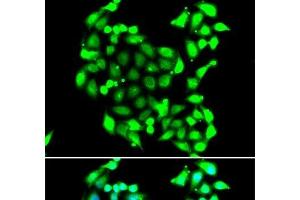 Immunofluorescence analysis of A549 cells using GTF2H3 Polyclonal Antibody