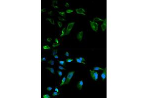 Immunofluorescence analysis of HeLa cells using NEK8 antibody (ABIN5970372). (NEK8 Antikörper)