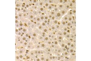 Immunohistochemistry of paraffin-embedded rat liver using SFN Antibody (ABIN5970403) at dilution of 1/100 (40x lens).