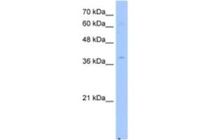 Western Blotting (WB) image for anti-NAD(P) Dependent Steroid Dehydrogenase-Like (NSDHL) antibody (ABIN2463049) (NSDHL Antikörper)