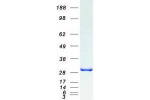 Western Blotting (WB) image for TIP41-like protein (TIPRL) (Transcript Variant 1) protein (Myc-DYKDDDDK Tag) (ABIN2733775)