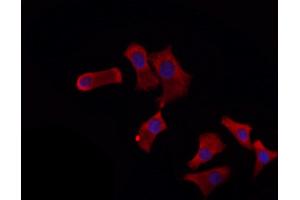 ABIN6260668 and ABIN6272272 staining HepG2 by IF/ICC. (CDC16 Antikörper  (Internal Region))