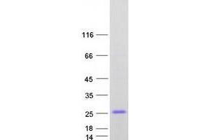 CSRP3 Protein (Transcript Variant 2) (Myc-DYKDDDDK Tag)