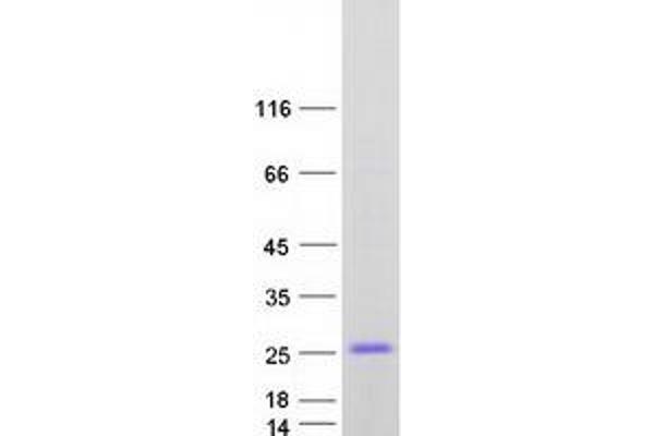 CSRP3 Protein (Transcript Variant 2) (Myc-DYKDDDDK Tag)