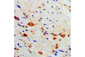 Immunohistochemical analysis of PKA C beta staining in human brain formalin fixed paraffin embedded tissue section.