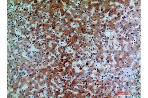Immunohistochemistry (IHC) analysis of paraffin-embedded Human Liver, antibody was diluted at 1:200. (C7 Antikörper)